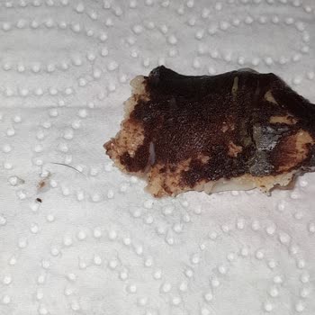 Ekleristan Eklerden Çıkan Kirpik