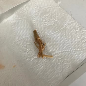 Dr. Oetker Ürünün İçinden Çıkan Yabancı Madde