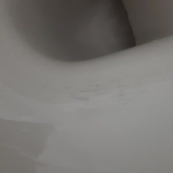 Vitra Klozet Kararması!