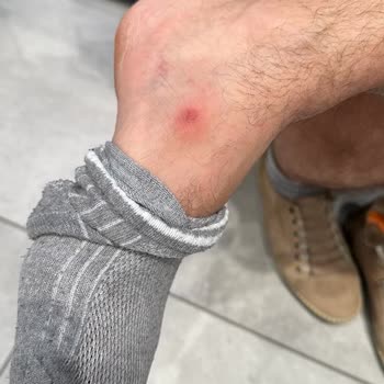 Ayağınıza Değil Cüzdanınıza Bakan Mağaza Arıyorsanız Skechers...