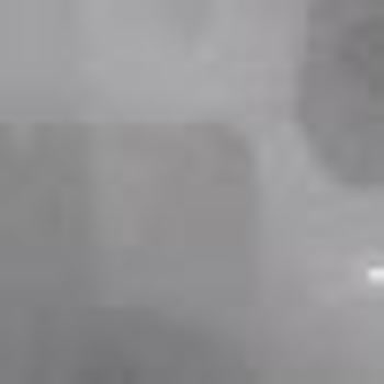 Coante Sararma Ve Çıkmayan Lekeler