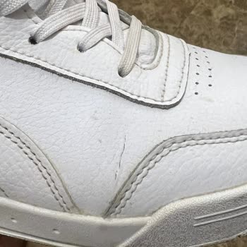 Trendyol Ayakkabım 2 Haftada Yırtıldı