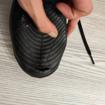Adidas Ayakkabı Aldım 2 Ay Kullanıldı Darbe Almadı Yırtıldı