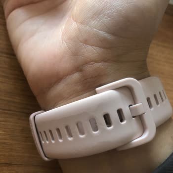 Huawei Bağlantı Kopuyor Kordon Rengi Değişti