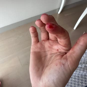 Abant Su Cam Damacana Tehlikeli