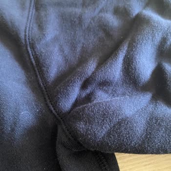 Amazon Defolu Ürün Gönderiliyor