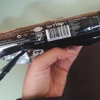 Eti Gıda Ürününde Hijyen Skandalı!