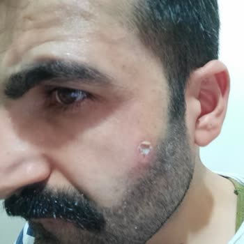 Manisa Suit Güzellik Merkezi İnsan Sağlığını Hiçe Sayma