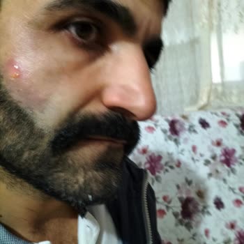 Manisa Suit Güzellik Merkezi İnsan Sağlığını Hiçe Sayma