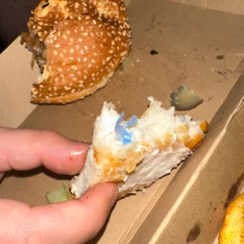 Burger Yiyelim Yemek İçerisinde Yabancı Madde