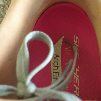 Skechers Markası'nın Üründen Kaynaklı Problemi Kabullenmemesi