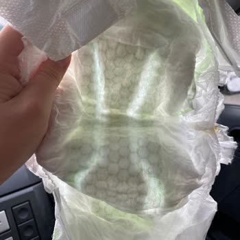 Bebem Natural Kalitesiz Bebek Bezi Hayal Kırıklığı