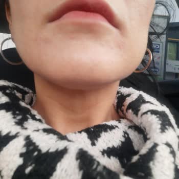 Day2day Para İadesi İstiyorum Çok Kotu Yan Etki Yaptı