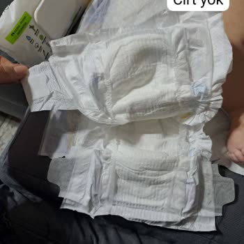 Molfix Paketten Defolu Bez Çıkıyor