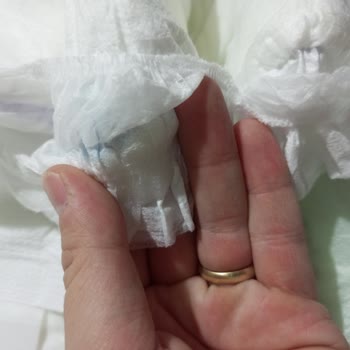 Molfix Çocuk Bezinde Yabancı Madde