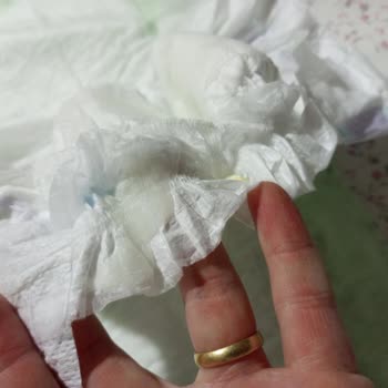 Molfix Çocuk Bezinde Yabancı Madde