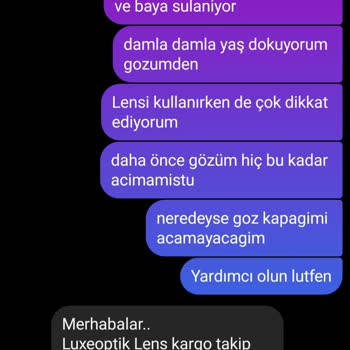 Labella Lens Lens Batma Ve Yanma Yapıyor. Sorunumla İlgilenmiyorlar, Cevap Alamadım