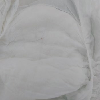 Sleepy 3 Midi Bebek Bezinin İç Kısmında Sivri Kahverengi Bir Cisim