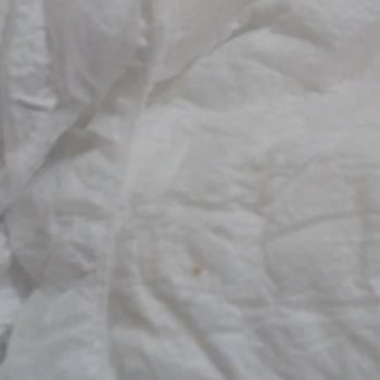 Sleepy 3 Midi Bebek Bezinin İç Kısmında Sivri Kahverengi Bir Cisim