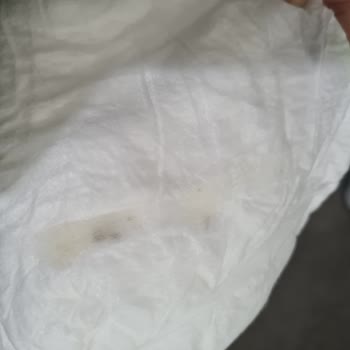 Baby Turco Bezin İçinde Yapışkan Bir Madde Plastik Gibi