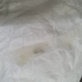 Baby Turco Bezin İçinde Yapışkan Bir Madde Plastik Gibi