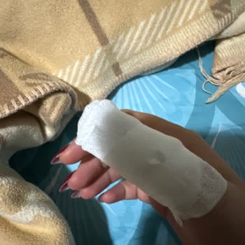 Nihal Nail Ataköy (Nail Art Studio) Dolama Enfeksiyon Oldu