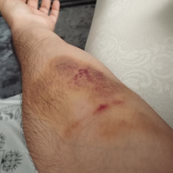 Şişli Hamidiye Etfal Eğitim ve Araştırma Hastanesi İş Bilmez Sağlık Görevlileri