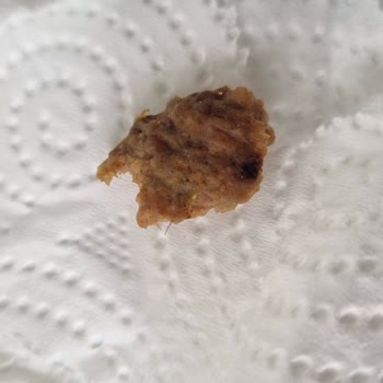 Namet Burger Kıl Sorunu