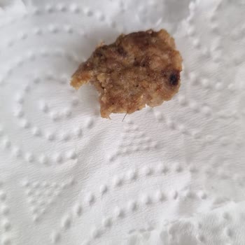 Namet Burger Kıl Sorunu