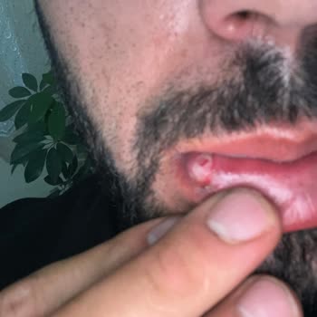 Tokat Ağız ve Diş Sağlığı Diş Tedavisi Sırasında Yaşanan Mağduriyet