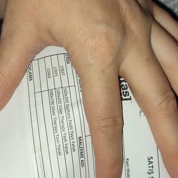 Yataş Yatak 1 Sene Olmadan Rahatsız Edici Bir Yatak