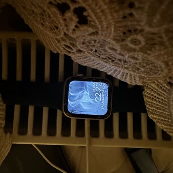 Apple Watch Cam Sorunu Ve Müşteri Mağduriyeti