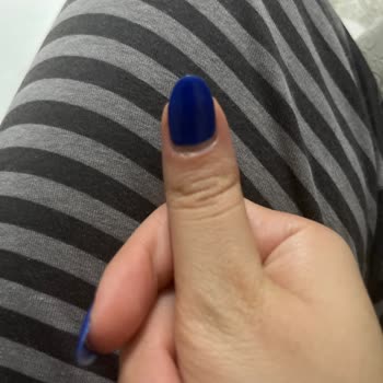 Eylül Öztürk Ataşehir Hijyen Sorunu