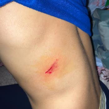 Özel Avrupa Tıp Merkezi (İzmir) Fazla Ücret Alınması