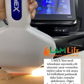 Glam Life Güzellik & Cilt Bakım Merkezi IPL Seans Ücreti Hüsranı