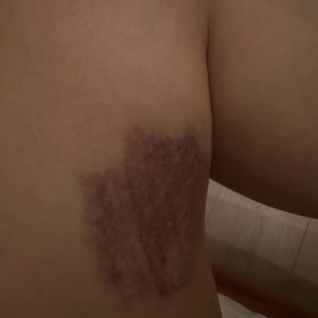 Ataşehir Medicaderma Şubesi Hayal Kırıklığı