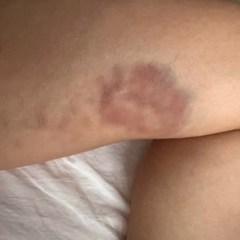 Ataşehir Medicaderma Şubesi Hayal Kırıklığı