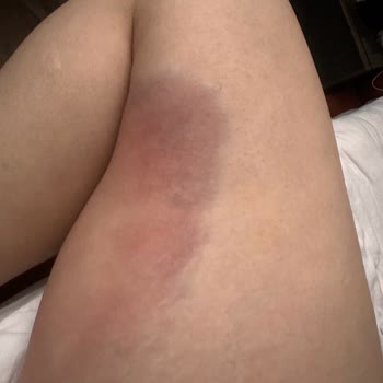 Ataşehir Medicaderma Şubesi Hayal Kırıklığı