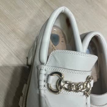 Aldo Shoes Aldo Ayakkabılar Cilt Yanığı Ve Yaralanma