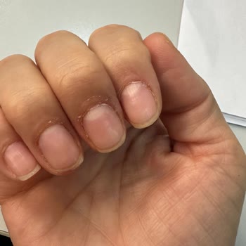 Melike Adıgüzel Güzellik Salonu Yapılan İşlemler ve Gösterilen Tavır