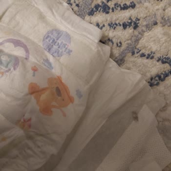 Molfix Pure & Soft Bebek Bezinin Hijyenik Koşullarda Üretilmemesi