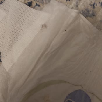 Molfix Pure & Soft Bebek Bezinin Hijyenik Koşullarda Üretilmemesi
