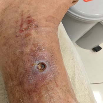 Kolan Hospital Kötü Hizmet Kötü Muamele