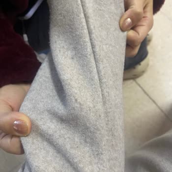 Zara Kaban Tüylendi Bir Ayda