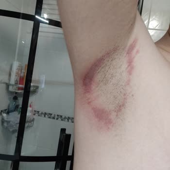 Old Spice Deodorant Yanığına Dikkat!