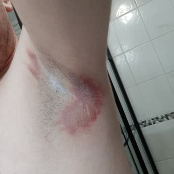 Old Spice Deodorant Yanığına Dikkat!