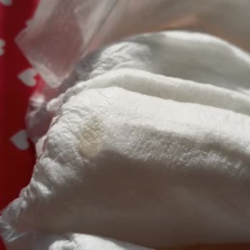 Pure Baby Bez İçerisindeki Yabancı Madde