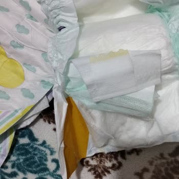 Jenny Willy Bez Paketinin Hepsi Yırtık Ve Yapışkansız