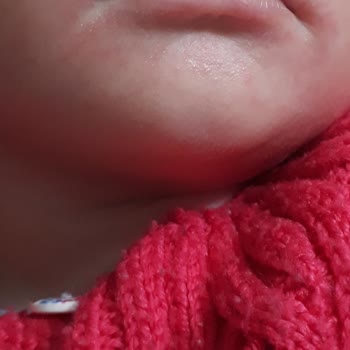 Karun AVM Bebek Bakım Odasında Ağır Kimyasal Kullanılması