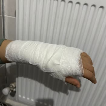 Trendyol'da Tehlikeli Düdüklü Tencere Kazası